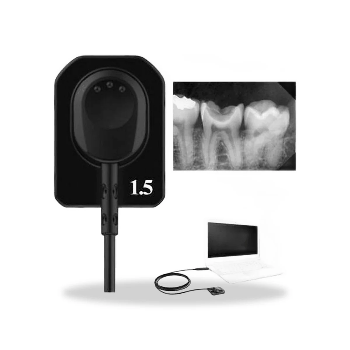 AppleDental Intraoral Sensor Size 1.5